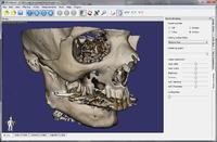 3DimViewer 3.1.1 screenshot. Click to enlarge!