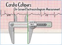 Cardio Calipers 3.3 screenshot. Click to enlarge!