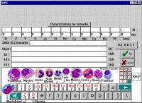 HemoDiff 1.0 screenshot. Click to enlarge!
