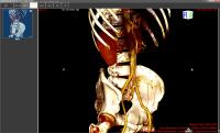 ORPALIS DICOM Viewer 1.3.0 screenshot. Click to enlarge!