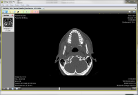 Portable Ginkgo CADx 3.6.1.1367.34 screenshot. Click to enlarge!