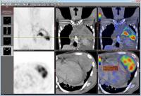 Portable RadiAnt Viewer 1.8.6.6744 screenshot. Click to enlarge!