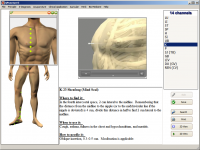 Qpuncture 3.00 screenshot. Click to enlarge!