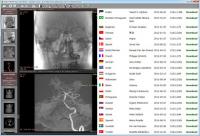 RadiAnt Viewer 1.8.6.6744 screenshot. Click to enlarge!