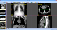 Sante CT Viewer 1.0.15 screenshot. Click to enlarge!