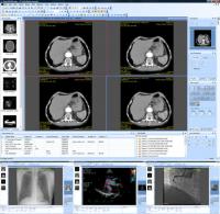 Sante DICOM Editor 4.1.10 screenshot. Click to enlarge!