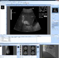 Sante DICOM Viewer 8.1.10 screenshot. Click to enlarge!