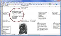 TreeDraw 4.4.2 screenshot. Click to enlarge!