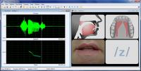 icSpeech 2.8.0 screenshot. Click to enlarge!