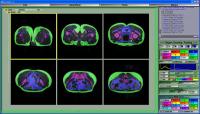 sliceOmatic 5.0 Rev-5e  screenshot. Click to enlarge!